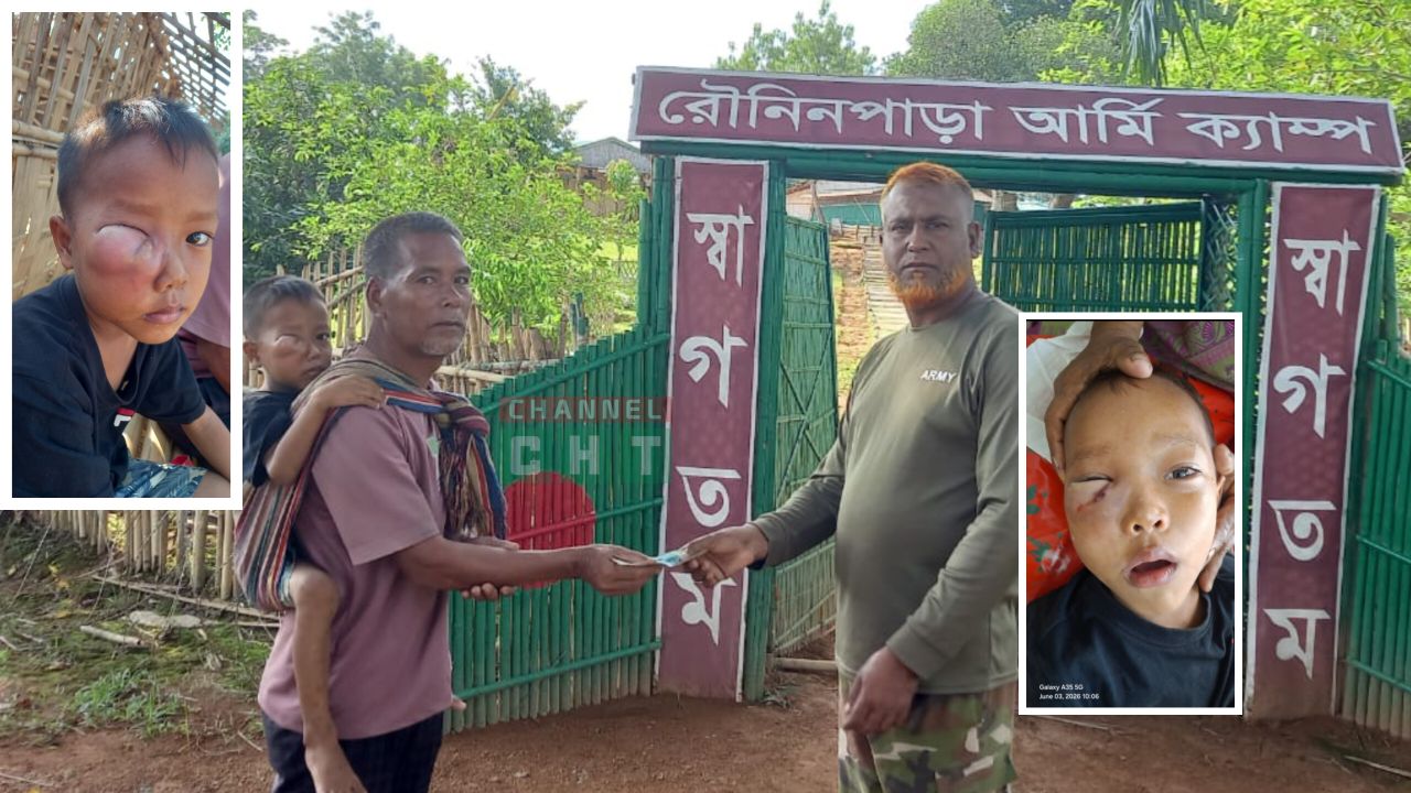 সেনাবাহিনীর তাৎক্ষণিক হস্তক্ষেপে রক্ষা পেল পাহাড়ি শিশুর চোখ: রৌনিনপাড়ায় আর্থিক ও চিকিৎসা সহায়তা প্রদান।