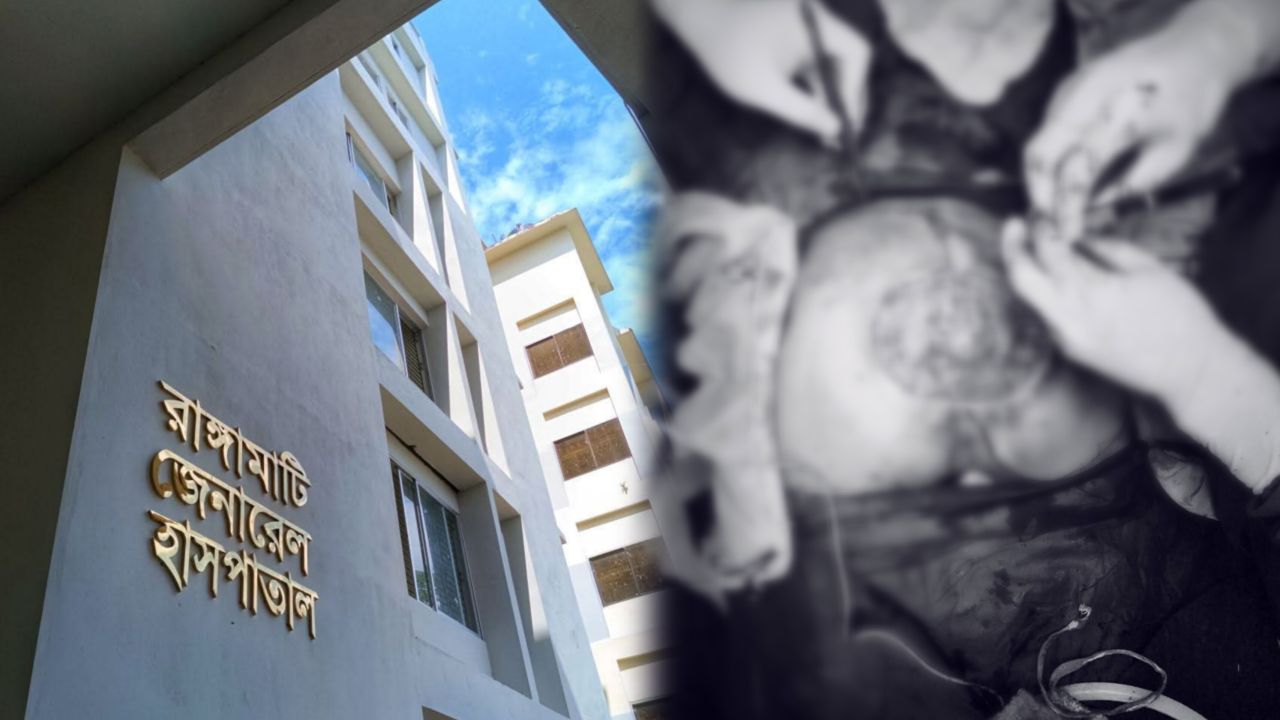 ৫ ঘণ্টার জটিল অস্ত্রোপচারে নতুন জীবন পেলেন বরকলের বিতারন দেওয়ান।