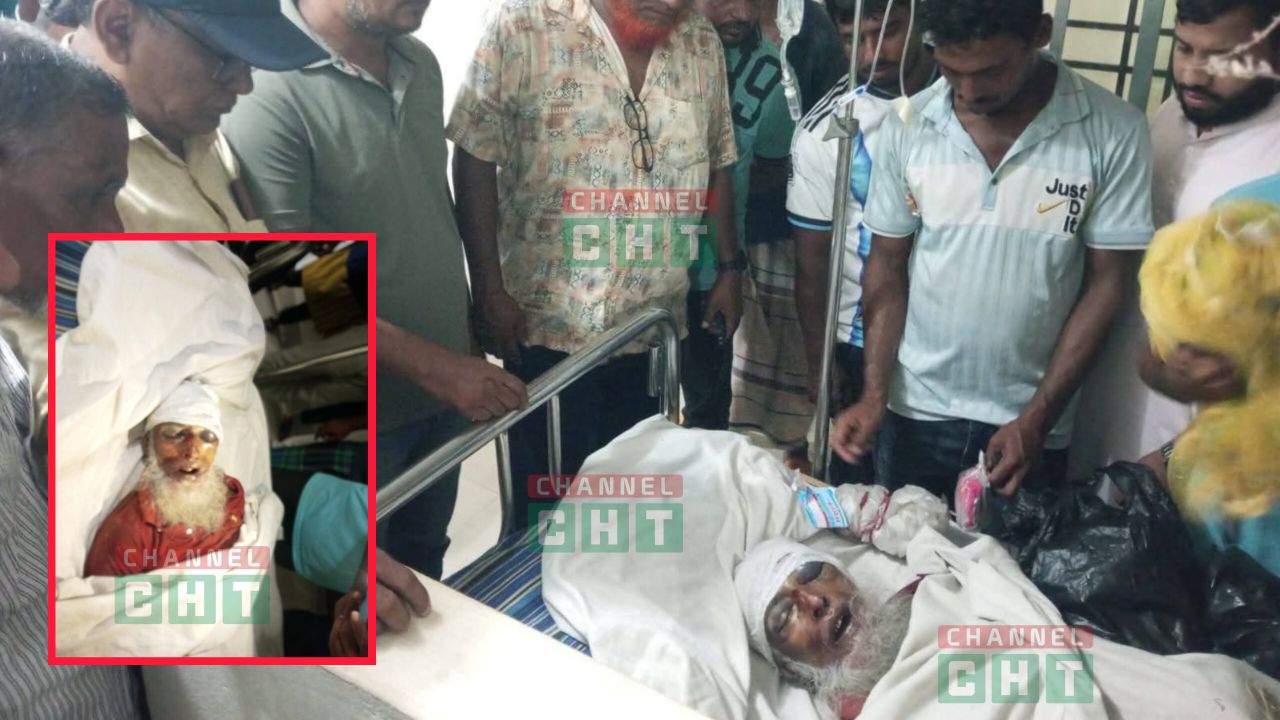রাঙ্গামাটিতে হোটেল সোনার বাংলা সংলগ্ন সড়কে সিএনজি দুর্ঘটনা, বৃদ্ধ নিহত; চালক আটক।